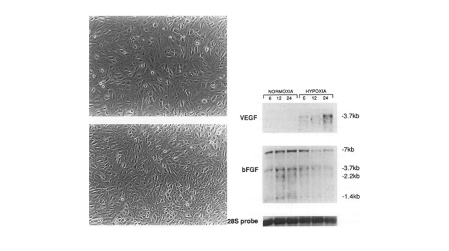 Human retinal pigment epithelium grown under normoxic (top left) and hypoxic (bottom left) conditions, and VEGF mRNA expression after 6, 12, and 24 hours of hypoxia (right)