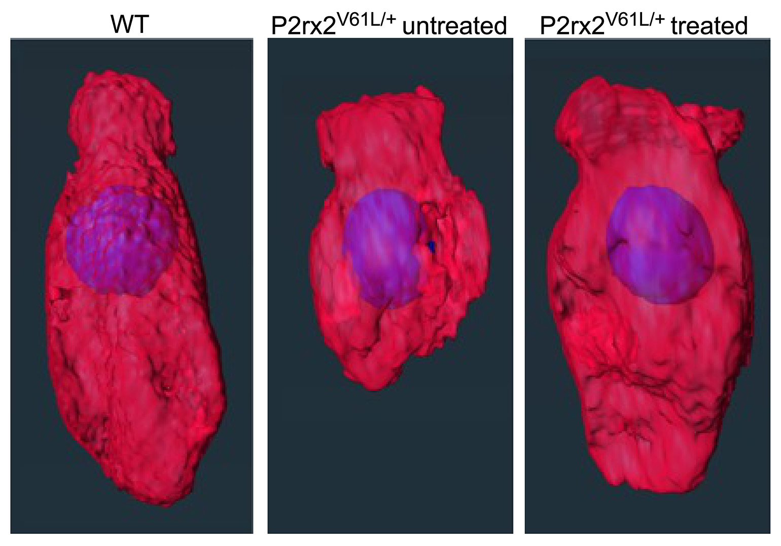 A graphic showing three inner hair cells: the wildtype (WT), untreated P2rx2 mutant and treated P2rx2 mutant