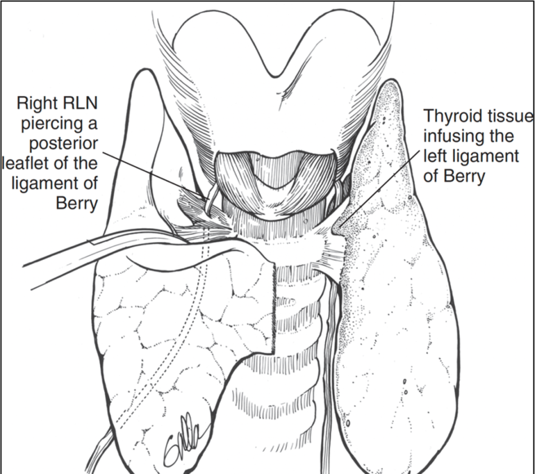 vcp-is-commonly-asymptomatic-in-rln-invasion-by-thyroid-cancer-mass