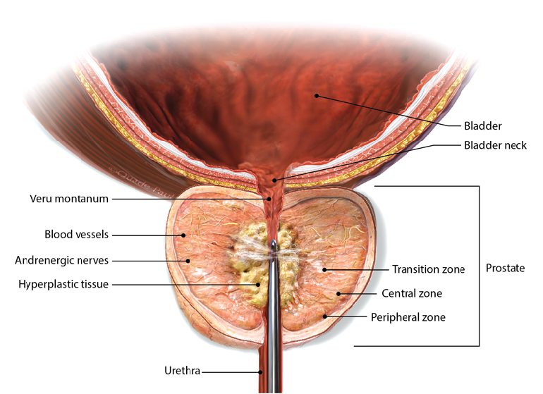 prostate anatomy lobes